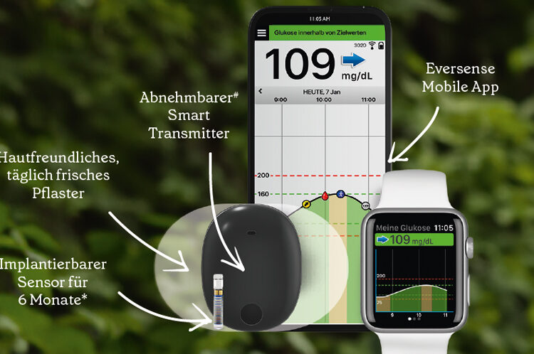 Diabetes Eversense E3